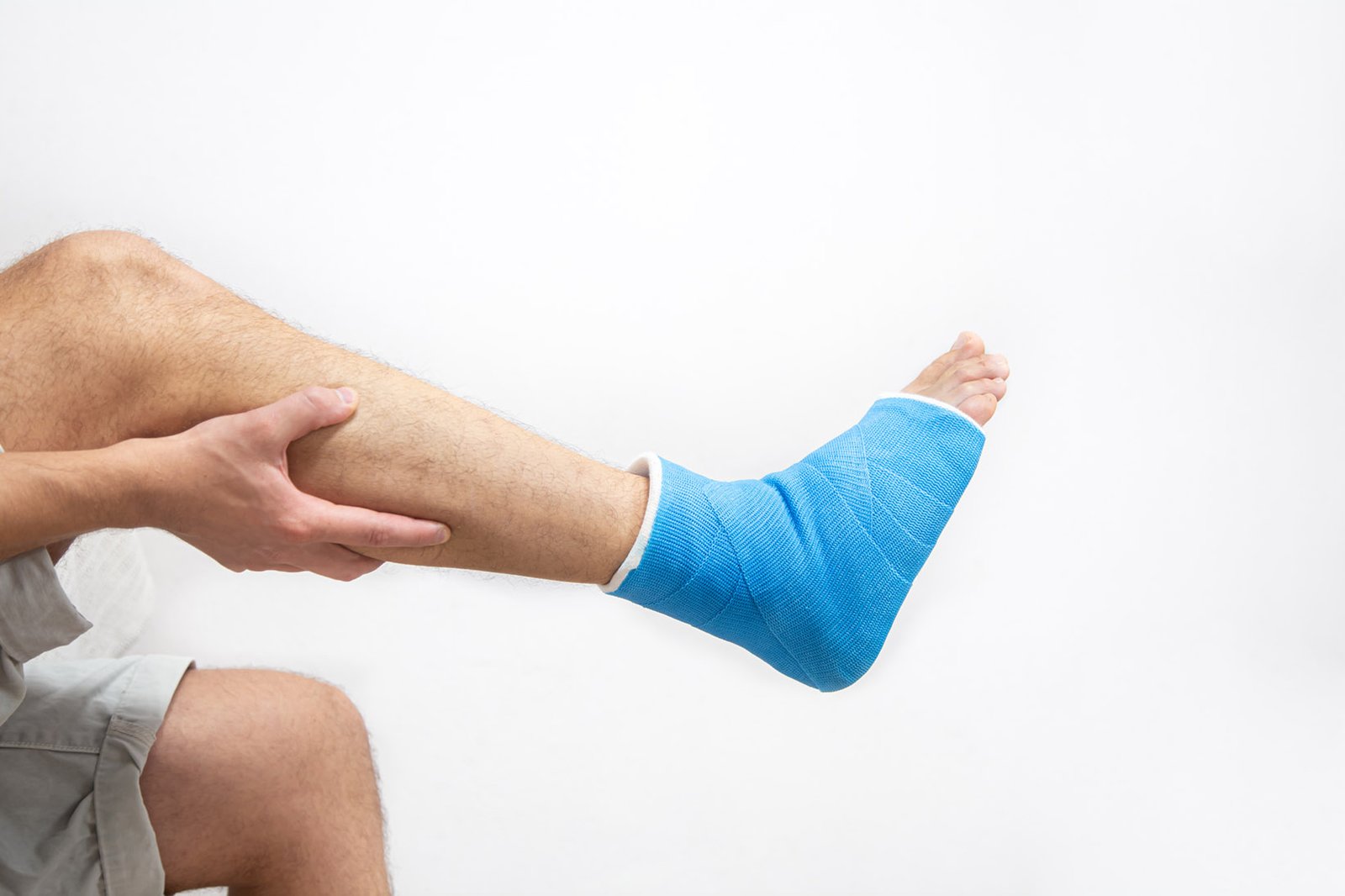 Bone fracture foot and leg on male patient close up.